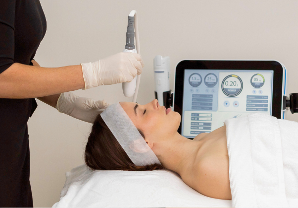 Liftera HIFU machine treatment with pen applicator for lifting on smaller areas like the orbital ridge