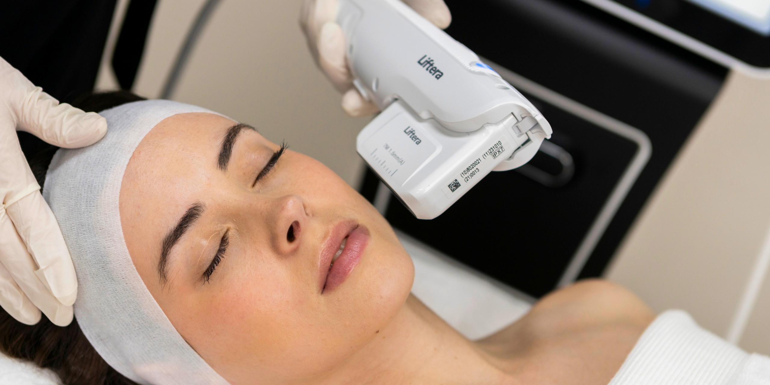 Liftera HIFU machine treatment image for facial HIFU lifting and rejuvenation